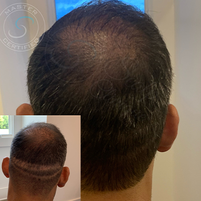 SMP Before & After